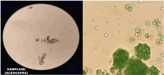 Figure 1. represented Gloeocapsopsis crepidinum under the microscope.