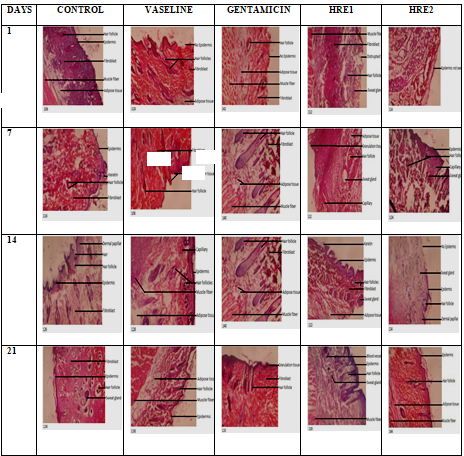 Amino Acid Profile, Total Protein and Histological Changes in Female Wistar Rats After Administration of Dichloromethane Extract of Heterotis Rotundifolia Leaves on Dermal Wound.